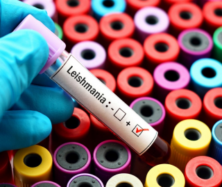 Test e vaccino Leishmania